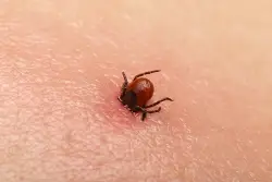 Potentially deadly bacteria found in invasive tick for first time in US