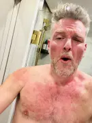 Pat McAfee gets brutalized at WWE Backlash: ‘My chest is burning’